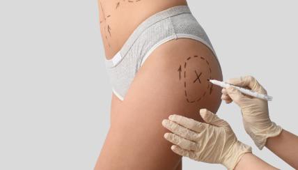 An image of a woman about to go under the knife for cosmetic surgery.