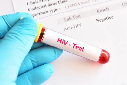 HIV test: Photo: iStock