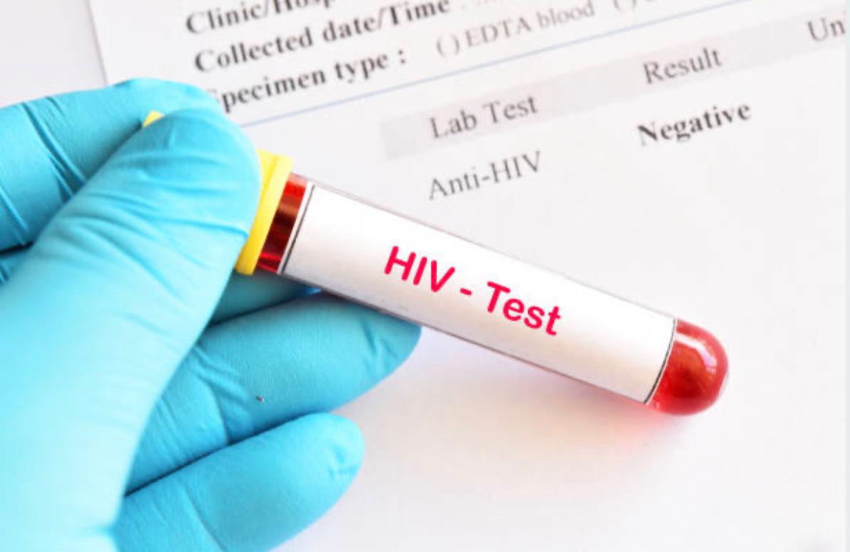 HIV test: Photo: iStock